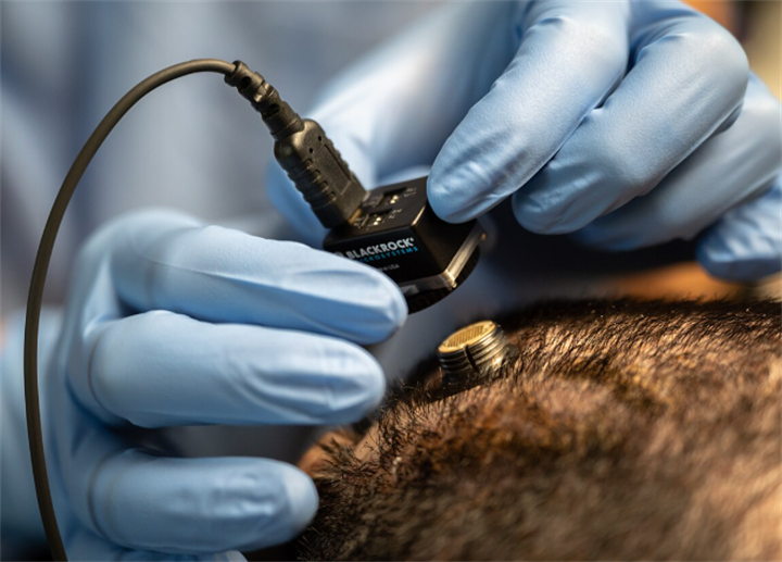 Surgeon’s gloved hands installing invasive microelectrode implant onto human scalp for BCI